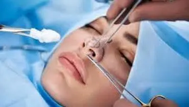 زمان مناسب برای شروع ورزش بعد از جراحی بینی
