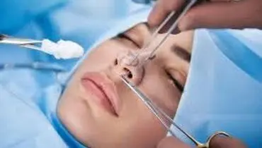 زمان مناسب برای شروع ورزش بعد از جراحی بینی
