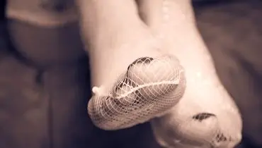 پارافیلیا چیست
