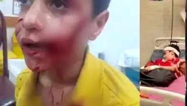 حمله سگ‌های ولگرد به کودک 11 ساله؛ امیرعلی جان خود را از دست داد