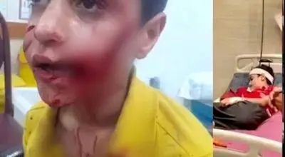 حمله سگ‌های ولگرد به کودک 11 ساله؛ امیرعلی جان خود را از دست داد