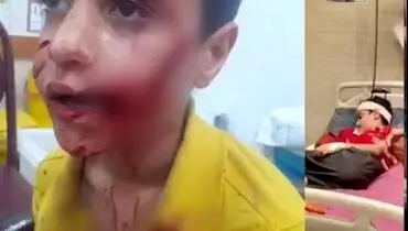 حمله سگ‌های ولگرد به کودک 11 ساله؛ امیرعلی جان خود را از دست داد