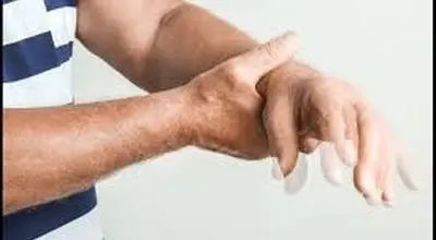 در یک‌قدمی درمان قطعی پارکینسون