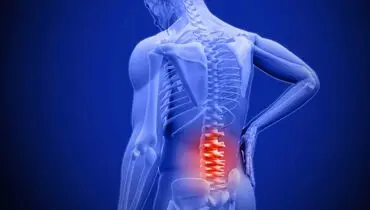 عامل پنهان کمردردهای مزمن مشخص شد
