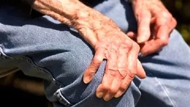 ۲ راهکار مهم در پیشگیری از پوکی استخوان