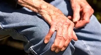 ۲ راهکار مهم در پیشگیری از پوکی استخوان