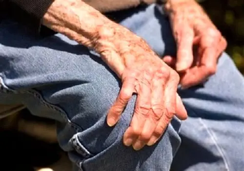 ۲ راهکار مهم در پیشگیری از پوکی استخوان