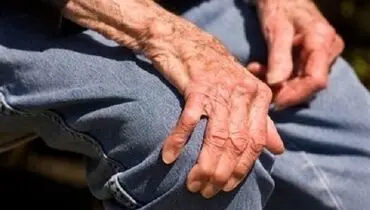 ۲ راهکار مهم در پیشگیری از پوکی استخوان