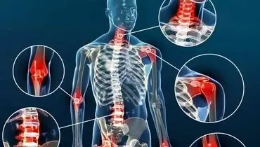 این تمرینات برای کاهش درد آرتروز به شما کمک می‌کنند