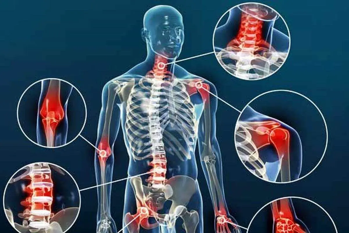 این تمرینات برای کاهش درد آرتروز به شما کمک می‌کنند