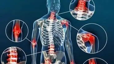 این تمرینات برای کاهش درد آرتروز به شما کمک می‌کنند