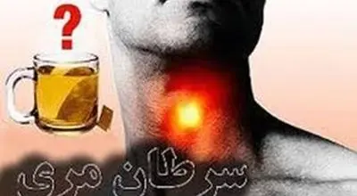 چای داغ؛ مهمترین عامل ایجاد سرطان مری در ایران/ویدیو 