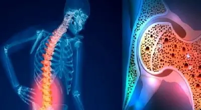 قوی ترین نسخه طب سنتی تقویت استخوان و مفاصل با کشمش