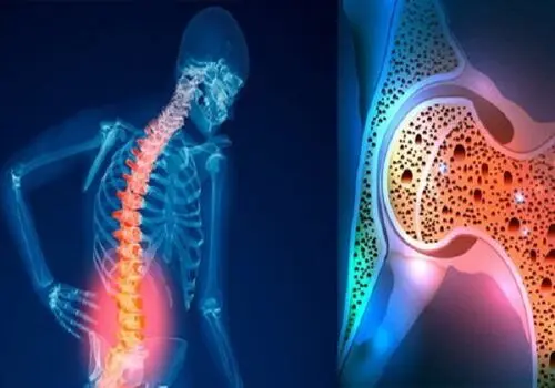 تقویت استخوان‌ها با یک خوراکی ساده و شیرین