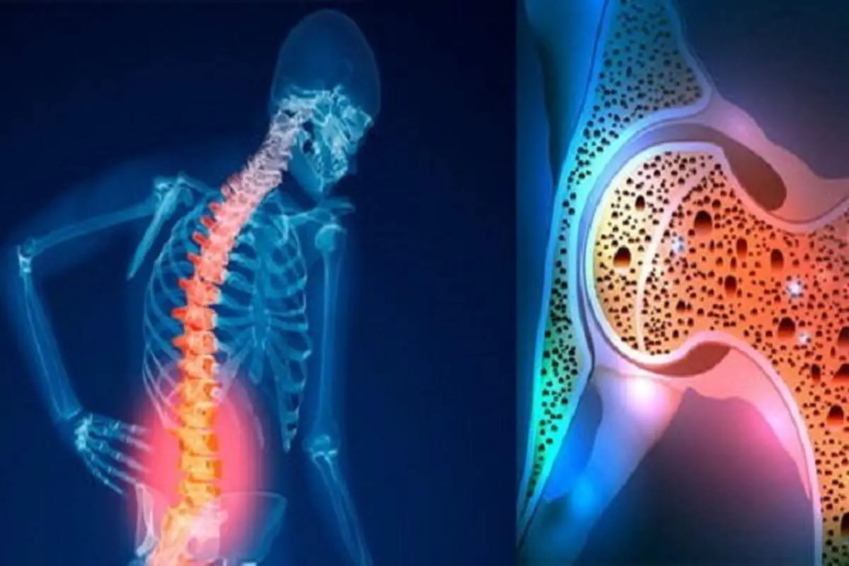 قوی ترین نسخه طب سنتی تقویت استخوان و مفاصل با کشمش