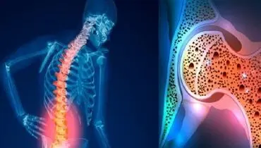 قوی ترین نسخه طب سنتی تقویت استخوان و مفاصل با کشمش