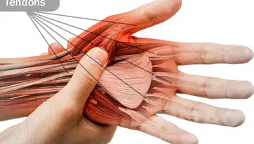 توصیه کارشناسان برای پیشگیری از آسیب تاندون‌ها
