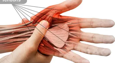 توصیه کارشناسان برای پیشگیری از آسیب تاندون‌ها
