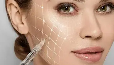 هشدار سازمان غذا و دارو درخصوص فیلرهای ارزان و اینترنتی