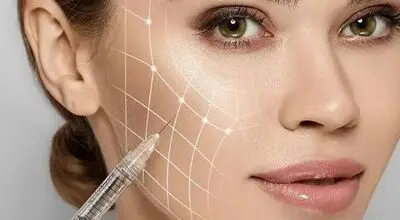 هشدار سازمان غذا و دارو درخصوص فیلرهای ارزان و اینترنتی