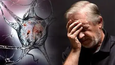 آلزایمر؛ بلای جان ایرانی ها!+ توصیه هایی برای پیشگیری