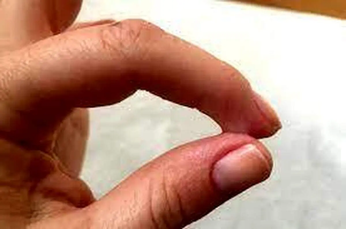 ترفند پاک کردن چسب های یک دو سه از روی پوست