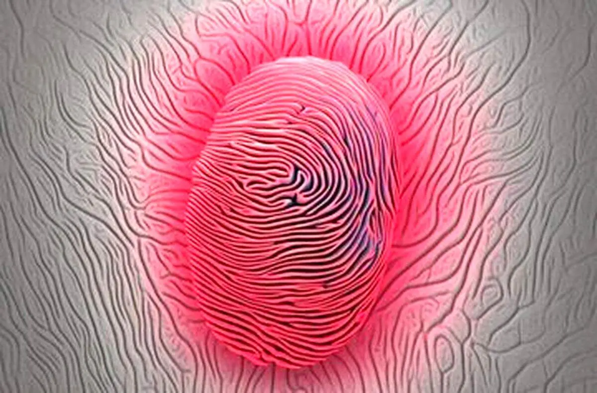 یک دستاورد شگفت انگیز درباره «اثر انگشت درد»