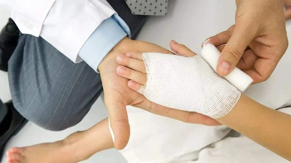 رایج‌ترین باورهای غلط درباره سوختگی‌