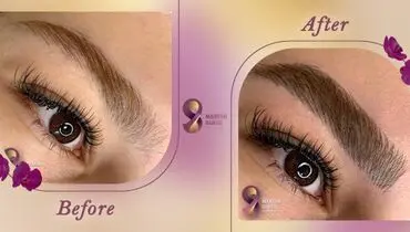 تکنیک میکروبلیدینگ در زیبایی و آرایش دائم
