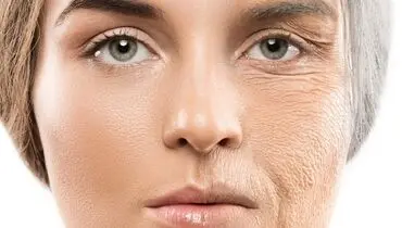 چرا برخی زنان در ۵۰ سالگی پوست ۲۵ ساله دارند