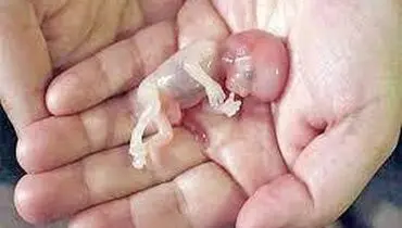 هیچگونه پیشنهاد قانونی در زمینه گشت مقابله با سقط جنین نداریم
