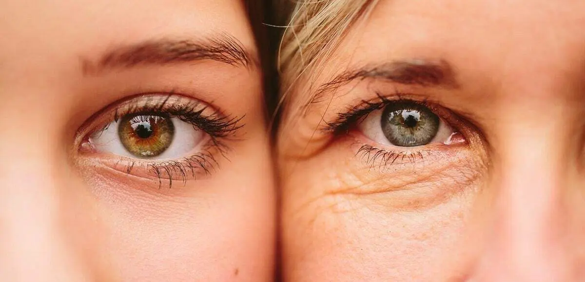 برای جلوگیری از چروک دور چشم چه کنیم؟