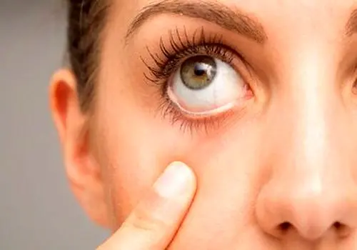 برای داشتن چشمانی سالم، هر دقیقه ۲۰ پلک بزنید