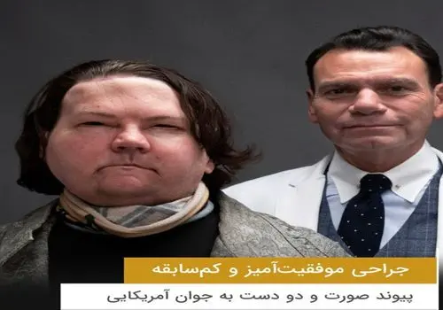 پیوند موفقیت آمیز چشم و صورت روی یک کهنه سرباز آمریکایی+ عکس