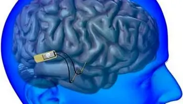 ایمپلنت‌های مغزی می‌توانند خصوصی‌ترین افکار انسان را بفهمند!