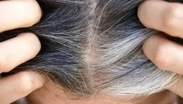 کشف راهی برای جلوگیری از سفید شدن موها
