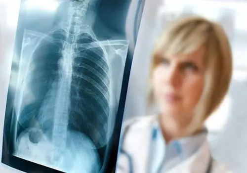 مصرف لبنیات پرچرب چه تاثیری بر روی عقل دارد؟

