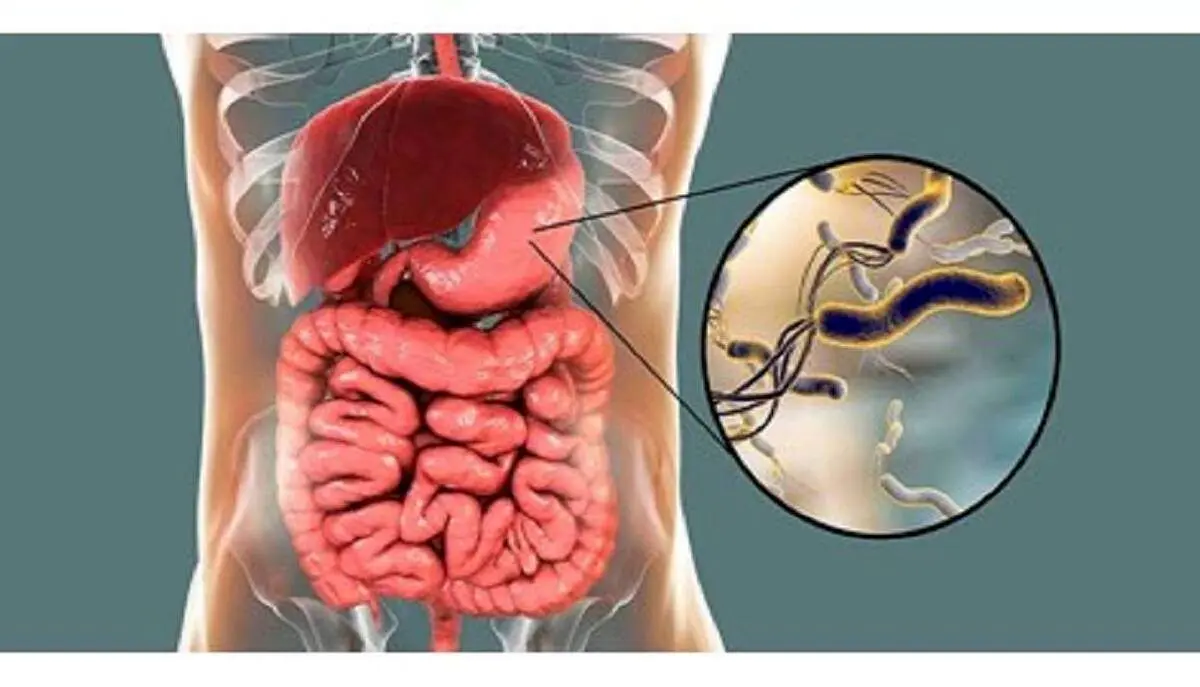 بیماران مبتلا به میکروب معده چه میوههایی بخورند؟