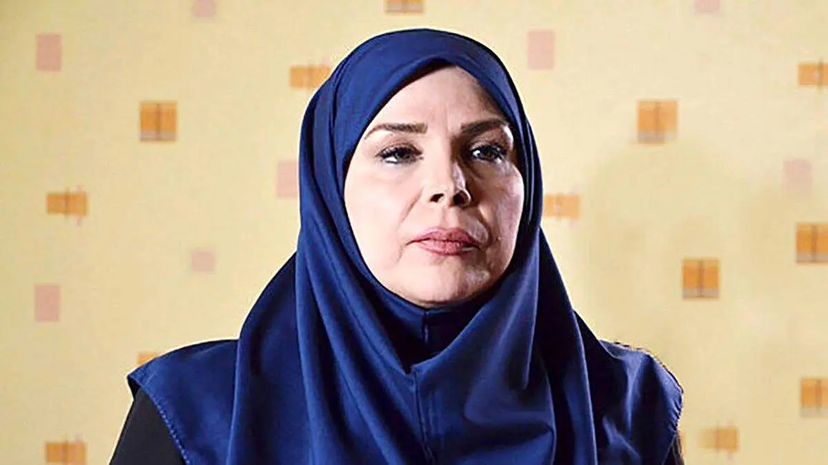 تغییر چهره خانم بازیگر باورنکردنی است!+ عکس