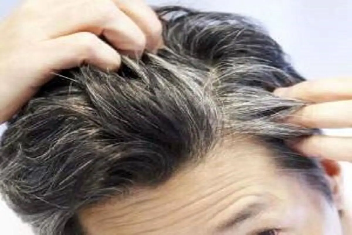 رفع سفیدی مو به روشی کاملا طبیعی