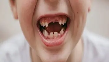 روشی عجیب برای کشیدن دندان با استفاده از ماشین شاسی بلند!+ فیلم