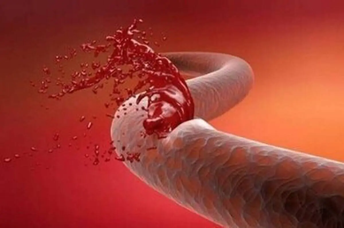 این مواد طبیعی خانگی خون را رقیق می کنند