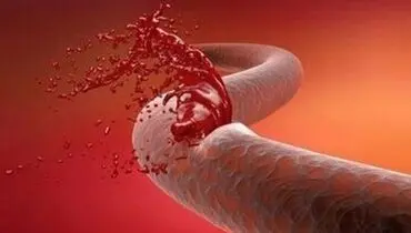 این مواد طبیعی خانگی خون را رقیق می کنند