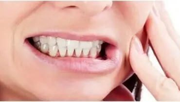 این اشتباهات رایج باعث زرد شدن دندان های شما می شود