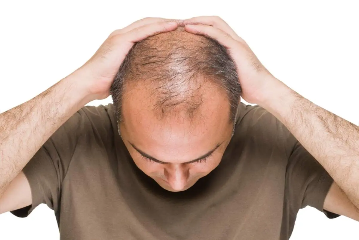 دم کرده این گیاه مانع ریزش مو می‌شود