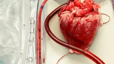 برای دومین بار در تاریخ صورت گرفت، پیوند قلب خوک به انسان!+ عکس