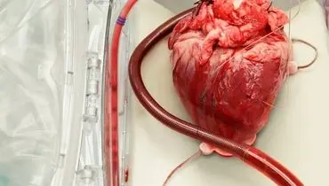 برای دومین بار در تاریخ صورت گرفت، پیوند قلب خوک به انسان!+ عکس