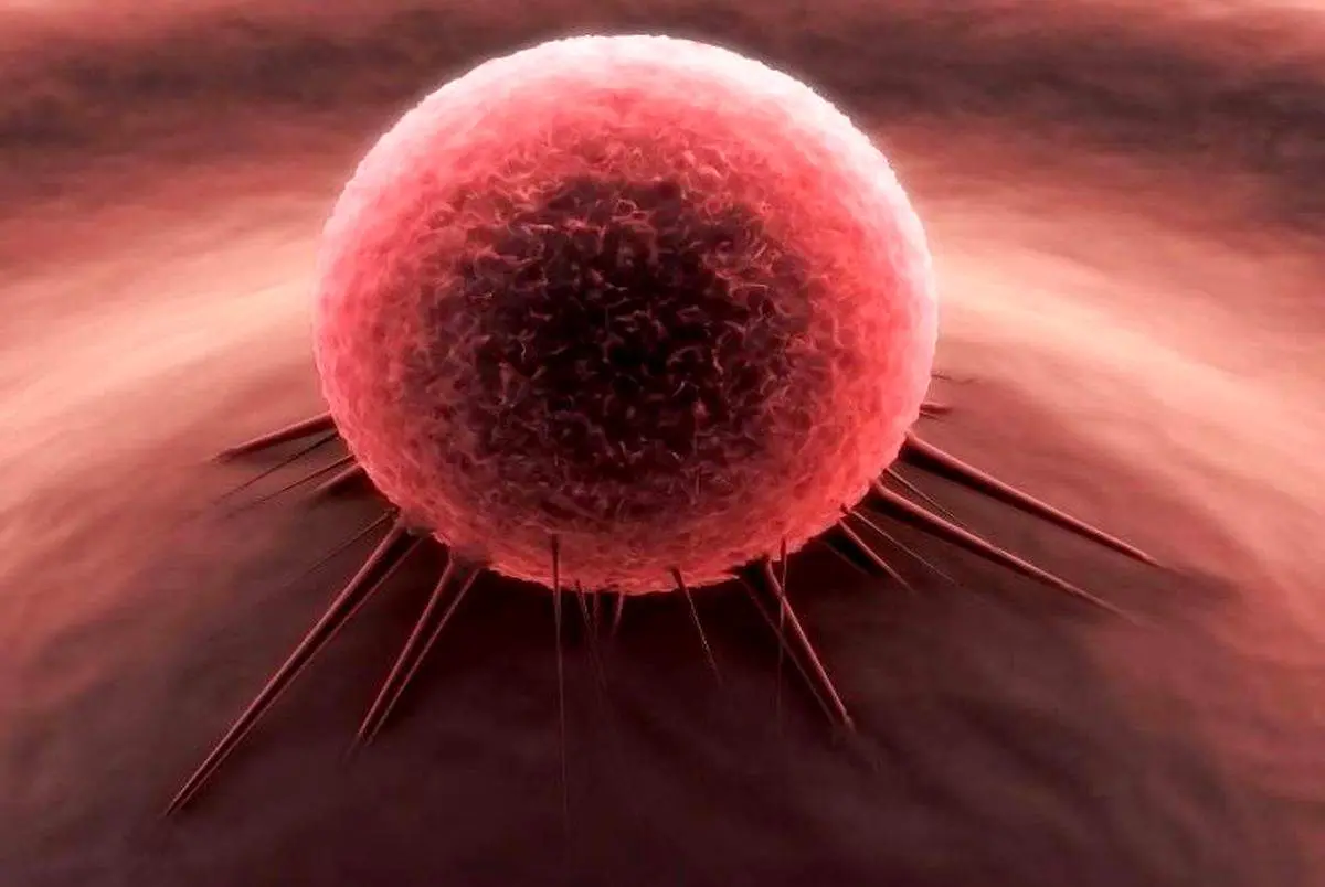 ۲ عامل اصلی ابتلا به سرطان را بشناسید