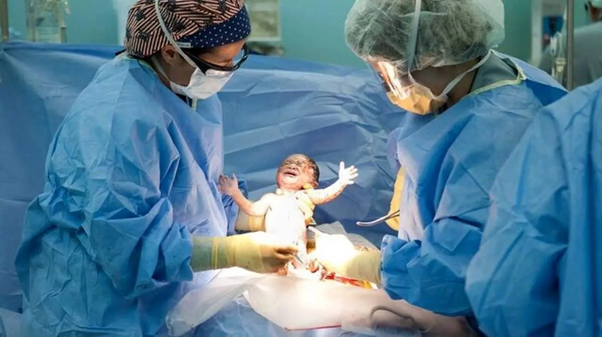 استقبال عجیب زنان از این جراحی پرمخاطره‌!