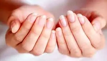 
با این ویتامین های معجزه گر، ناخن هایی زیبا داشته باشید!
